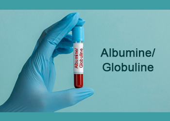 Albumine-Globuline